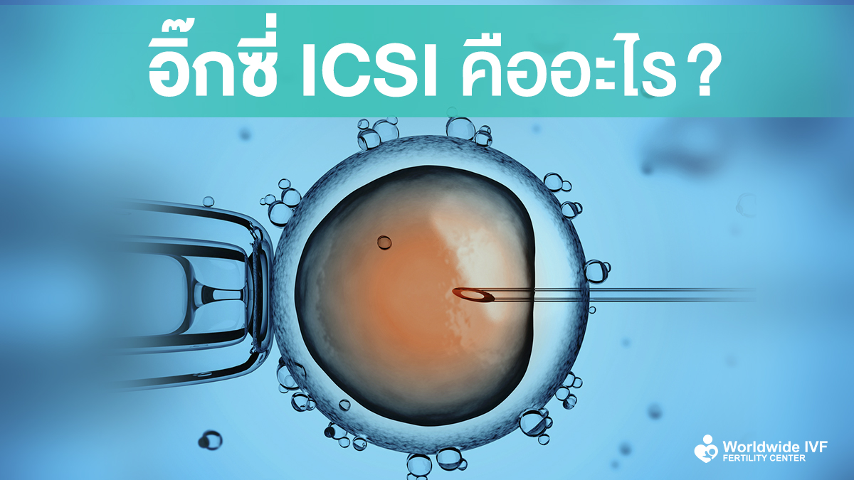 การทำ ICSI คืออะไร