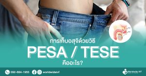 การเก็บอสุจิ ด้วยวิธี PESA/TESE แม้เป็นหมันก็มีลูกได้